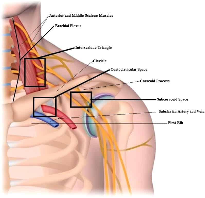 anatomy of the thoracic outlet syndrome that can cause tingling and numbness in the hand or arm